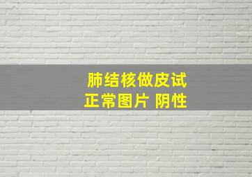 肺结核做皮试正常图片 阴性